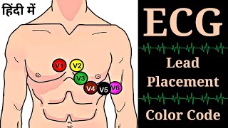 ECG in Hindi  12 ECG Lead Placement  ECG Lead Color Code  ECG Lead Position  Nursing  GNM [upl. by Brandais519]