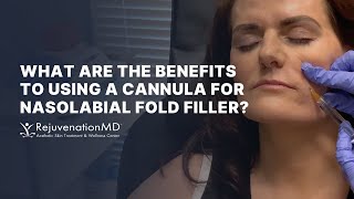 Cannula Artistry Transforming Nasolabial Folds with Filler [upl. by Norabel733]