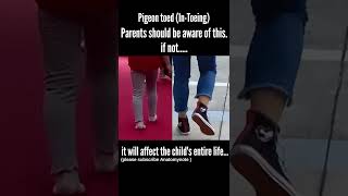 Pigeon Toed walking Intoeing baby walking  parents should be aware of shorts [upl. by Llewkcor946]