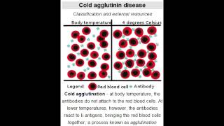 Cold Agglutinin Disease autoimmune hemolytic anemia Mycoplasma Pneumoniae amp Mononucleosis [upl. by Anekam302]