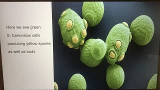 Saccharomyces Cerevisiae Presentation [upl. by Casie]