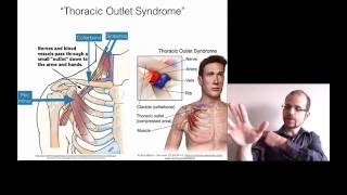 How to treat pain or cold or numbness in the whole hand  Thoracic Outlet Syndrome [upl. by Attelocin]