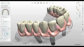 How to Design a Digital All on X Implants Bridge with the Thimble Crowns in 3Shape [upl. by Amir443]