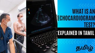 What is EchoCardiogram Test in Tamil  Echo Test for Heart  Echo Cardiology Test  Badhusha [upl. by Odelia792]