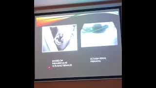 ecografia renal en pediatria dra tarde [upl. by Weissmann889]