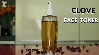 Diy facial toner for acne prone dry and combo skin [upl. by Akcire720]