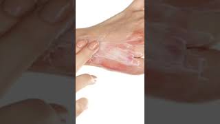 Mederma Cream Lagane se Pahle Kuchh Tips  How to use mederma Cream [upl. by Jammin]