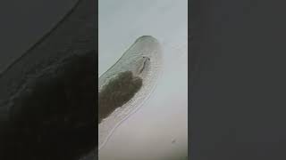 Flatworm Platyhelminthes under the microscope microscopy microscope science biology [upl. by Aisyat]