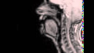 MRI voiceless alveolar affricate [upl. by Sachiko]