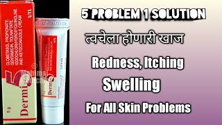 Fungal InfectionBacterial Infection Skin InfectionEczemaRash Dermi 5 Cream Review Marathi [upl. by Corly]