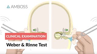 Weber and Rinne Test  Clinical Examination [upl. by Barraza690]