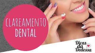 Clareamento Dental  DICAS DA DEDESSA [upl. by Mohn]