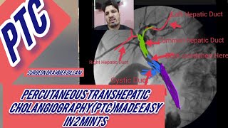 PTCpercutaneous Transhepatic Cholangiography Made Easy [upl. by Urd103]