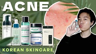 ACNE Treatment  6 Korean Skincare for Oily amp Acne Prone Skin 💦 🇰🇷 [upl. by Nilloc]