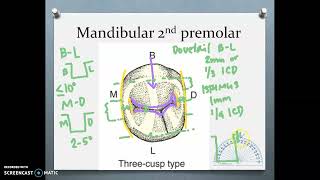 Mandibular 2nd premolar Class I conventional cavity design B [upl. by Chamberlin]