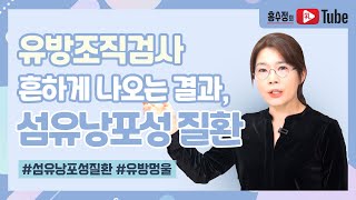 유방조직검사 하면 흔히 나오는 결과 섬유낭성 질환 [upl. by Zetta]