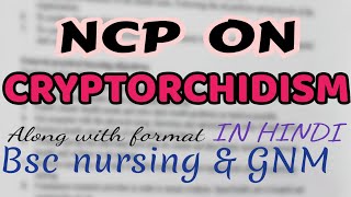 Nursing care plan on CRYPTORCHIDISM child health nursingmedical surgical nursingGNMBSC [upl. by Kreg]