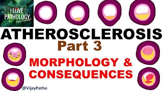 ATHEROSCLEROSIS Part 3  Morphology and consequences [upl. by Good689]