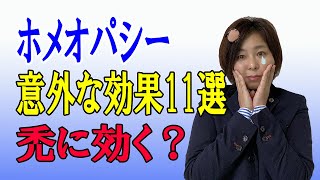 【ホメオパシー レメディー】ホメオパシー意外な効果11選、禿に効く？ [upl. by Benildis]