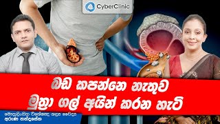 බඩ කපන්නෙ නැතුව මුත්‍රා ගල් අයින් කරන හැටි [upl. by Imojean609]