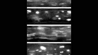 Axonal Organelle Transport in Motion [upl. by Oluap]