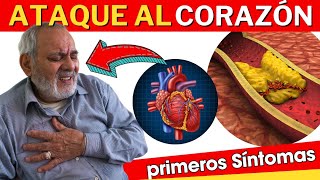 💔 SINTOMAS de INFARTO en Mujeres y Hombres ATAQUE AL CORAZÓN [upl. by Ona]