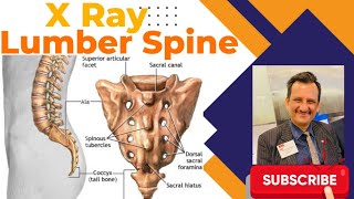 X RAY Lumbar Spine In Hindi  x ray Lumbosacral Spine ApLat xray ajaykaushik sheetalchhaya [upl. by Rosenberg]