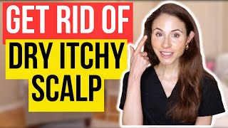 Get Rid Of Dry Itchy Scalp FAST [upl. by How]