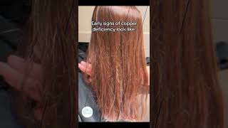 Early signs of copper deficiency by Sadia khan [upl. by Sivrep904]