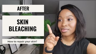 How to repair your skin after depigmentation or skin bleaching Part 2 [upl. by Avivah]