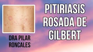 Pitiriasis rosada de Gilbert ¿qué es ¿hay que hacer algo [upl. by Maurizia]