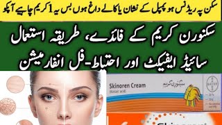 Skinoren Cream Uses and Side Effects  How To Use skinoren cream  Azelaic Acid Cream DrZaheer [upl. by Sisxela]