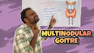 MULTINODULAR GOITRE  THYROID  MEDICINE  SURGERY  SHEELAM SRUJAN [upl. by Nela382]