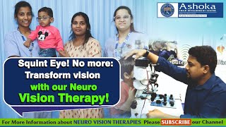 Get Cure of Your Squint Eyes with Neuro Vision Therapy  Best Neuro Vision Therapy Centre in Hyd [upl. by Khosrow152]