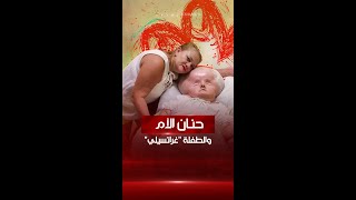 رعت ابنتها المصابة بالاستسقاء في الرأس لمدة 31 عاماً من دون أي ملل أو كلل [upl. by Ahseniuq]