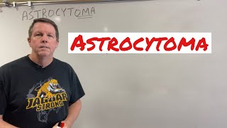 Astrocytomas Brain Tumors Explained [upl. by Nial129]