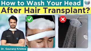 🤷‍♂️How to Wash Your Head After Hair Transplant Hair wash amp Shampoo After Hair Transplant [upl. by Devland871]