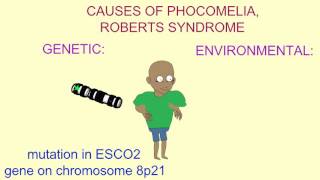 GENETIC amp ENVIRONMENTAL CAUSES OF PHOCOMELIA [upl. by Mot]