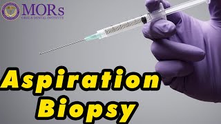 FINE NEEDLE ASPIRATION BIOPSY PROCEDURE [upl. by Eilrebmik472]