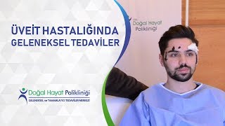 Üveit Hastalığında quotGeleneksel Tedaviler quot [upl. by Forras932]