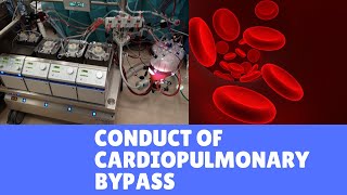 Conduct of Cardiopulmonary bypass [upl. by Linsk]