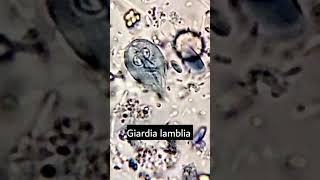 Giardia lambliaGiardiasis parasiteparasite under microscope microscopy parasitology [upl. by Akissej]