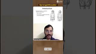 A Small overview of Sprengel Shoulder by Dr Faheem Kotekar [upl. by Etoile]