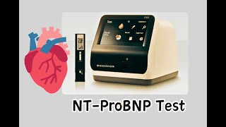 NTProBNP test  Cardiac Marker STANDARD™ F [upl. by Lot]