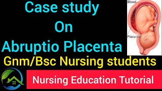 CASE STUDY ON ABRUPTIO PLACENTA for all Nursing students by NET [upl. by Scharaga]