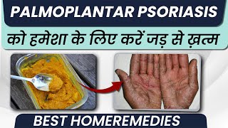 पामोप्लांटर सोरायसिस का घरेलू इलाज  Palmoplantar Psoriasis Symptoms and Treatment in Hindi [upl. by Doran]