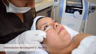 Rejuvenecimiento Facial  Exilis Ultra [upl. by Nomrej816]