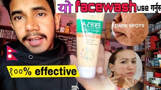 यो Acnes Facewash किन लगाउने  Acnes Facewashको फाइदाहरु के के छन  Cosmetic Nepal [upl. by Eehc]