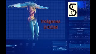 🩻​⚕️Imágenes DICOM 🩺​🚑​ Características y visualización [upl. by Kwang]