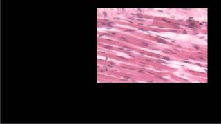 Differentiating Muscle Tissues [upl. by Meldoh]